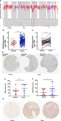 WTAP Is Correlated With Unfavorable Prognosis, Tumor Cell Proliferation, and Immune Infiltration in Hepatocellular Carcinoma